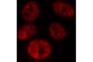 ABIN6269077 staining 293 by IF/ICC.