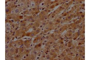IHC image of ABIN7127592 diluted at 1:100 and staining in paraffin-embedded human liver tissue performed on a Leica BondTM system. (Recombinant KLKB1 anticorps)