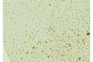 ABIN6276533 at 1/100 staining Mouse liver tissue by IHC-P.