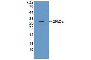 Figure. (Phospholipase C gamma 2 anticorps  (AA 930-1152))