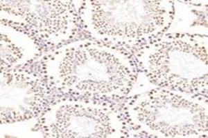 Immunohistochemistry analysis of paraffin-embedded rat testis using,RanBP16 (ABIN7073901) at dilution of 1: 2000 (Exportin 7 anticorps)
