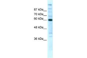 WB Suggested Anti-POLR2B Antibody Titration:  5ug/ml  Positive Control:  HepG2 cell lysate (POLR2B anticorps  (N-Term))