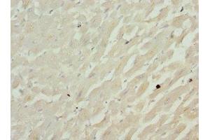 Immunohistochemistry of paraffin-embedded human heart tissue using ABIN7148048 at dilution of 1:100 (Cofilin 2 anticorps  (AA 1-166))