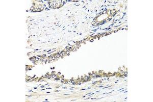 Immunohistochemistry of paraffin-embedded human prostate using BRCA1 antibody. (BRCA1 anticorps  (AA 120-220))