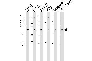 Western blot analysis of lysates from 293T, Hela, Jurkat, Y79 cell line , mouse spleen and rat kidney tissue lysate(from left to right), using DHFR Antibody (N-term) (ABIN6242878 and ABIN6577408). (Dihydrofolate Reductase anticorps  (N-Term))