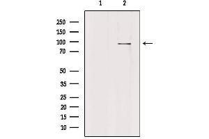 Western blot analysis of extracts from HepG2, using PLA2G4F Antibody. (PLA2G4F anticorps  (C-Term))