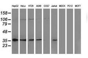 Image no. 2 for anti-Nonhomologous End-Joining Factor 1 (NHEJ1) antibody (ABIN1499732) (NHEJ1 anticorps)