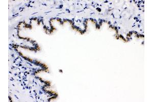 Anti-ARSA Picoband antibody,IHC(P) IHC(P): Rat Lung Tissue (Arylsulfatase A anticorps  (C-Term))