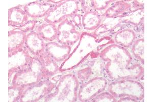 Human Kidney: Formalin-Fixed, Paraffin-Embedded (FFPE)