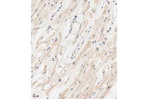 Immunohistochemical analysis of paraffin-embedded human heart tissue using A performed on the Leica® BOND RXm.