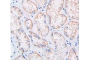 Figure. (Multimerin 1 anticorps  (AA 807-1053))