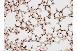 IHC-P Image Immunohistochemical analysis of paraffin-embedded human lung, using BAF57, antibody at 1:100 dilution. (SMARCE1 anticorps  (C-Term))