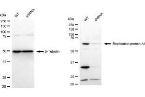 Western blotting analysis using Replication protein A1 antibody (ABIN7800172).