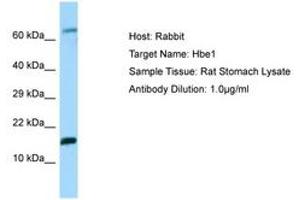 Image no. 1 for anti-Hemoglobin, epsilon 1 (HBe1) (N-Term) antibody (ABIN6749928) (Hemoglobin, epsilon 1 (HBe1) (N-Term) anticorps)