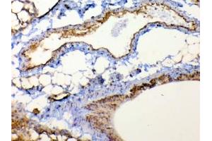 IHC testing of FFPE mouse lung tissue with TSPAN12 antibody at 1ug/ml. (TSPAN12 anticorps)
