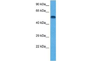 Host:  Rat  Target Name:  TUBB2A  Sample Tissue:  Rat Brain  Antibody Dilution:  1ug/ml (TUBB2A anticorps  (N-Term))