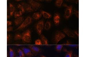 Immunofluorescence analysis of U-2 OS cells using CAD Polyclonal Antibody at dilution of 1:100.