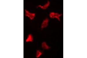 ABIN6276120 staining HepG2 by IF/ICC.