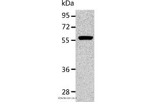 Western blot analysis of K562 cell, using ALDH1A2 Polyclonal Antibody at dilution of 1:400