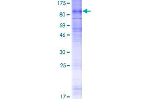Image no. 1 for Solute Carrier Family 28 (Sodium-Coupled Nucleoside Transporter), Member 2 (SLC28A2) (AA 1-658) protein (GST tag) (ABIN1320343)