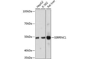 Western blot analysis of extracts of various cell lines, using SERPINC1 Rabbit mAb (ABIN7270208) at 1:1000 dilution. (SERPINC1 anticorps)