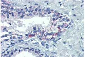 Human Prostate: Formalin-Fixed, Paraffin-Embedded (FFPE) (OR51E1 anticorps  (AA 79-141))