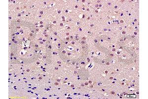Formalin-fixed and paraffin embedded rat brain labeled with Anti-Thrap3/TRAP150 Polyclonal Antibody, Unconjugated (ABIN1387545) at 1:200 followed by conjugation to the secondary antibody and DAB staining (THRAP3 anticorps  (AA 631-730))