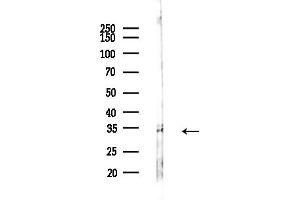 Western blot analysis of lysates from COLO205 cells(heat-shock,45 min treatment), using M Antibody at 1/1000 dilution.