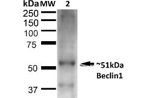 Western blot analysis of Rat Liver showing detection of ~51 kDa Beclin 1 protein using Rabbit Anti-Beclin 1 Polyclonal Antibody (ABIN2868751). (Beclin 1 anticorps  (FITC))