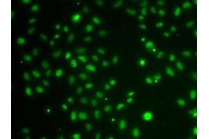 Immunofluorescence analysis of A-549 cells using POU6F1 antibody.