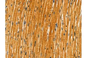 ABIN6261761 and ABIN6266840 at 1/100 staining Rat heart tissue by IHC-P. (FKRP anticorps  (N-Term))