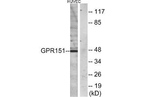 Western blot analysis of extracts from HUVEC cells, using GPR151 antibody. (GPR151 anticorps  (C-Term))