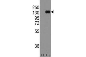 Western blot analysis of anti-E Cadherin antibody and 293 cell lysate (2 ug/lane) either nontransfected (Lane 1) or transiently transfected with the CDH1 gene (2).