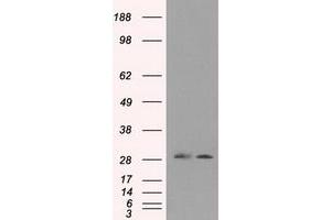 Image no. 1 for anti-Replication Protein A2, 32kDa (RPA2) antibody (ABIN1500734) (RPA2 anticorps)