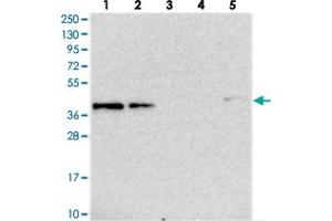 Western blot analysis of Lane 1: RT-4, Lane 2: U-251 MG, Lane 3: Human Plasma, Lane 4: Liver, Lane 5: Tonsil with TMEM164 polyclonal antibody  at 1:250-1:500 dilution. (TMEM164 anticorps)