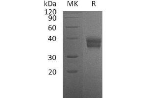 Western Blotting (WB) image for Carbonic Anhydrase 12 (CA12) protein (His tag) (ABIN7320477)