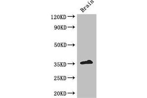 Western Blot Positive WB detected in: Mouse brain tissue All lanes: ZFP42 antibody at 3 μg/mL Secondary Goat polyclonal to rabbit IgG at 1/50000 dilution Predicted band size: 35 kDa Observed band size: 35 kDa (ZFP42 anticorps  (AA 6-68))