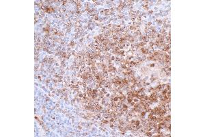 Immunohistochemistry (IHC) image for anti-HLA-DR-gamma (CD74) antibody (ABIN7449435)