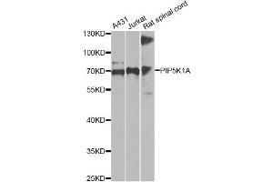Western blot analysis of extracts of various cell lines, using PIP5K1A antibody (ABIN6292233) at 1:1000 dilution. (PIP5K1A anticorps)