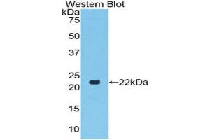 Western blot analysis of the recombinant protein. (TLR7 anticorps  (AA 887-1036))