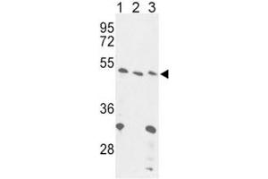 Western blot analysis of FOXP3 antibody and (1) 293, (2) Jurkat and (3) mouse liver lysate. (FOXP3 anticorps  (AA 283-311))