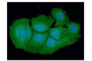 ICC/IF analysis of VTA1 in Hep3B cells line, stained with DAPI (Blue) for nucleus staining and monoclonal anti-human VTA1 antibody (1:100) with goat anti-mouse IgG-Alexa fluor 488 conjugate (Green).