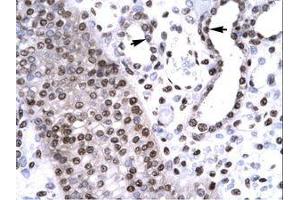 anti-BarH-Like Homeobox 2 (BARHL2) (AA 165-214) antibody