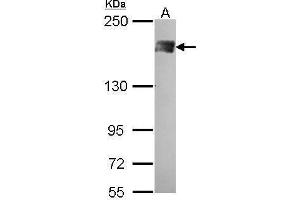 WB Image Sample (30 ug of whole cell lysate) A: A431 , 5% SDS PAGE PB1 antibody antibody diluted at 1:500 (Polybromo 1 anticorps  (N-Term))