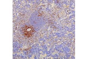 IHC analysis of CD8A using anti-CD8A antibody (ABIN6719524).