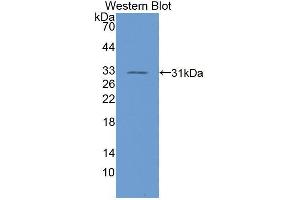 Western blot analysis of the recombinant protein. (RGS19 anticorps  (AA 1-217))