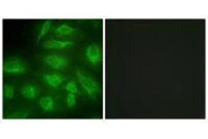 Immunofluorescence analysis of HeLa cells, using DGKI antibody.