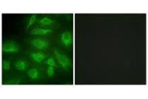 Immunofluorescence analysis of HeLa cells, using DGKI antibody. (DGKI anticorps  (C-Term))