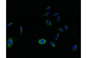Immunofluorescent analysis of HepG2 cells using ABIN7166799 at dilution of 1:100 and Alexa Fluor 488-congugated AffiniPure Goat Anti-Rabbit IgG(H+L) (SVOPL anticorps  (AA 73-129))