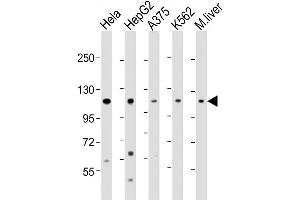Western Blot at 1:2000 dilution Lane 1: Hela whole cell lysate Lane 2: HepG2 whole cell lysate Lane 3: A375 whole cell lysate Lane 4: K562 whole cell lysate Lane 5: mouse liver lysate Lysates/proteins at 20 ug per lane.